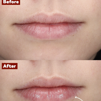 Plump Lip 10ml
